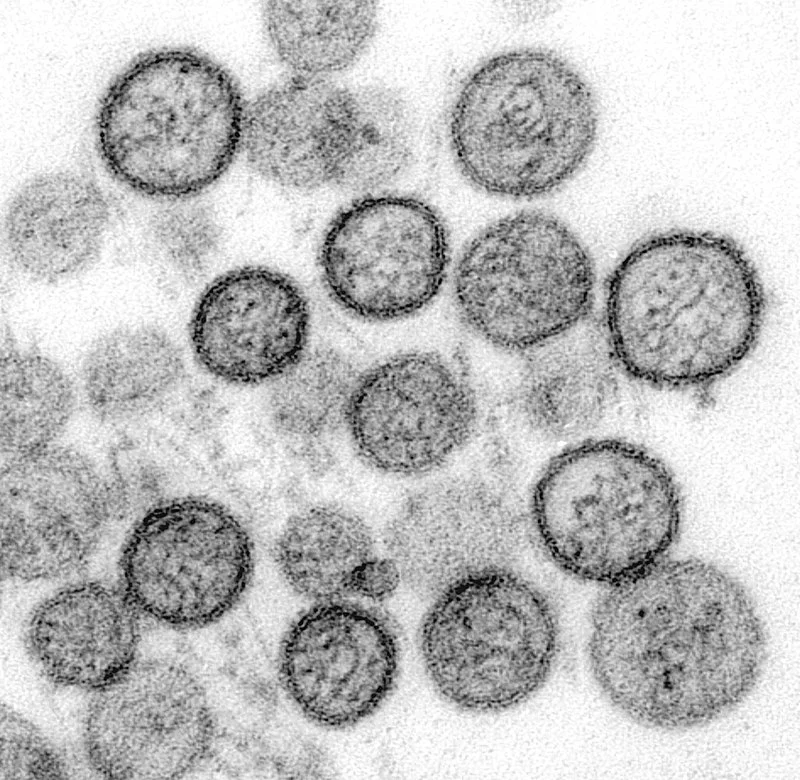 Hantavírus: Estrutura, Transmissão e Impacto Epidemiológico